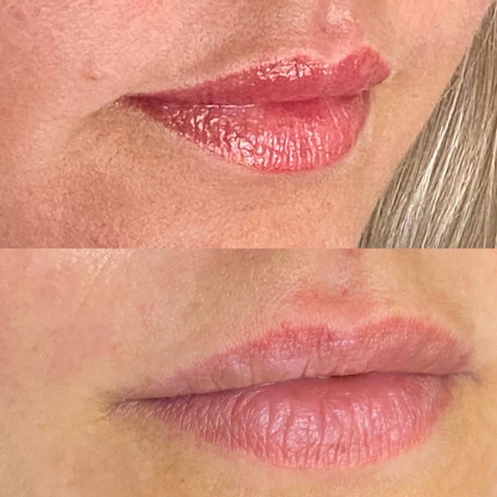 Labbra + Ritocco
